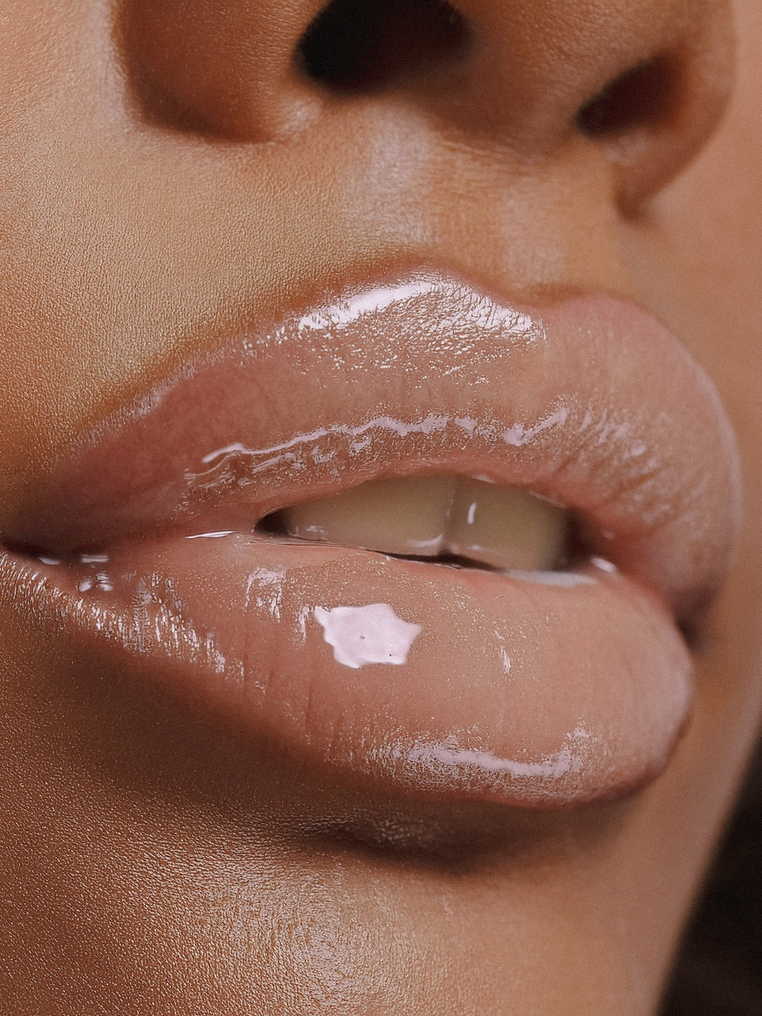 Lip Filler Aftercare: What every practitioner needs their client to know